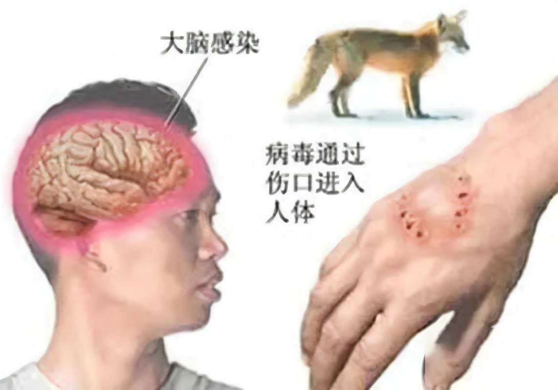 【世界狂犬病日】狂犬病知识你知多少？_莱州市中医医院